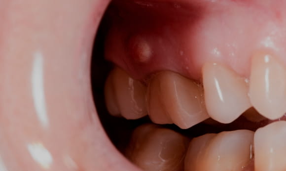 Treatment -  Royal Wharf Dental
