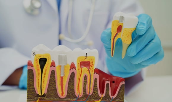 Treatment -  Royal Wharf Dental